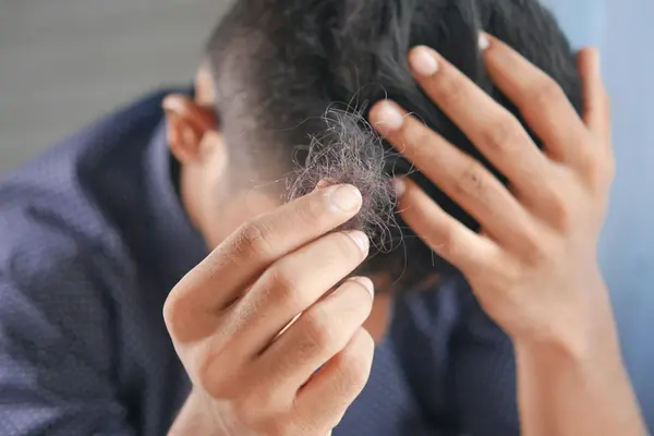 Man checking his thinning hair